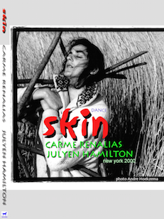 skin